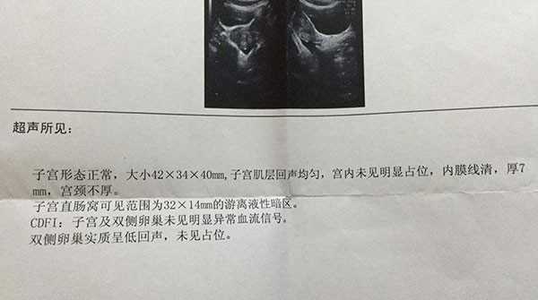 浙江大学附属妇产科医院能借赠卵做供卵试管婴儿吗？